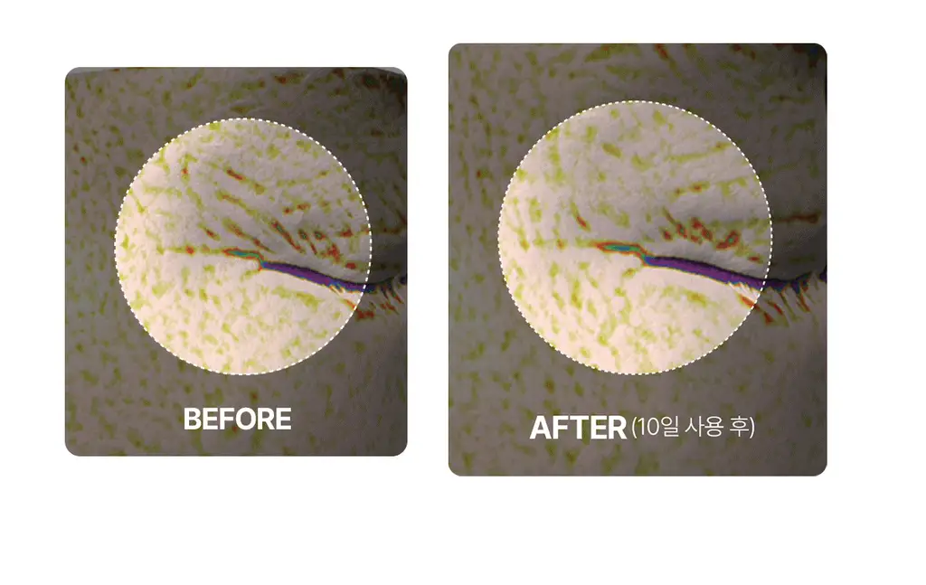 [주름잡는] 센텔리안24 링클셀 코어 아이크림 더블 기획 (세럼10ml x 2ea 증정) 상세페이지 11